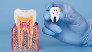 Caries, dentista en Getafe. ¿Empaste o endodoncia?